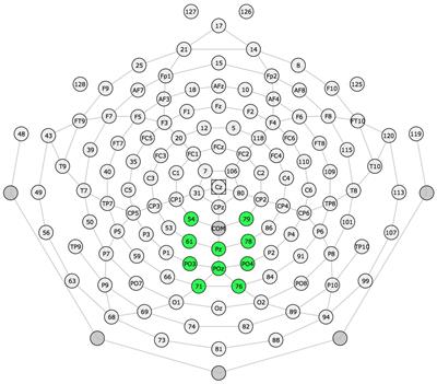 The P300 event related potential predicts phonological working memory skills in school-aged children